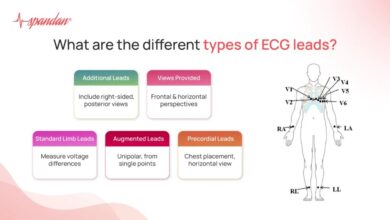 leads on ecg